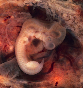 Ембріон людини